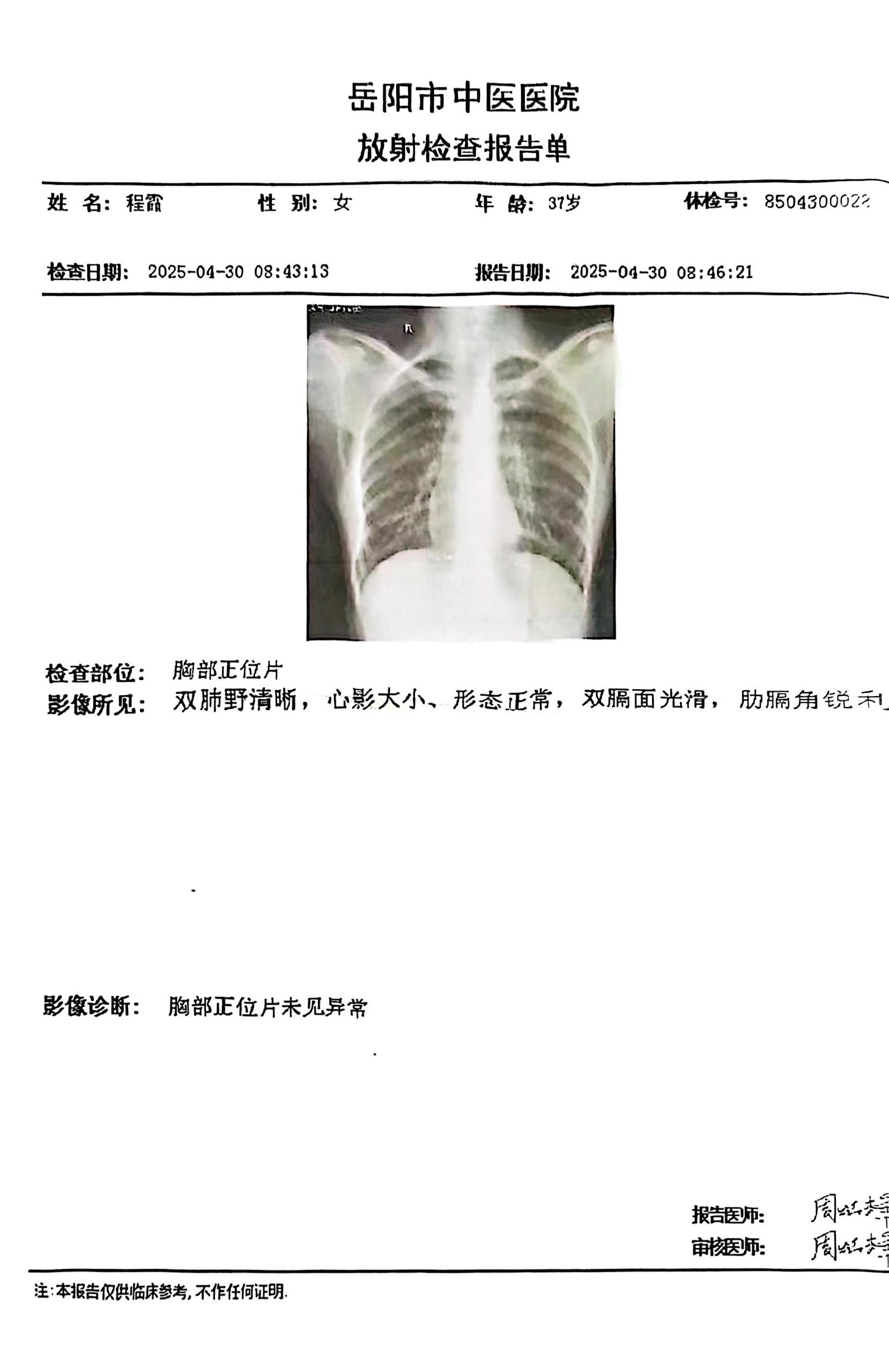 獲得其他